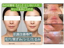 ボディキュア グランド(Body cure Grand)