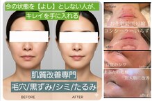 ボディキュア グランド(Body cure Grand)