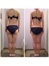 ナレル(narrel)/(新潟市/骨盤/痩身/ダイエット)