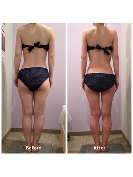 ナレル(narrel)/(新潟市/骨盤/痩身/ダイエット)