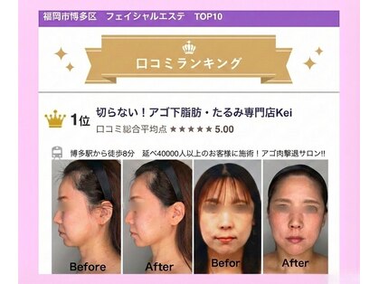 ケイ(Kei)の写真