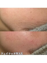 ネイルズビー 別邸(Nail's be)/フェイシャルワックス