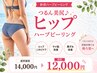 【つるん美尻♪針状ハーブピーリング】ヒップニキビケア・サメ肌・黒ずみ改善