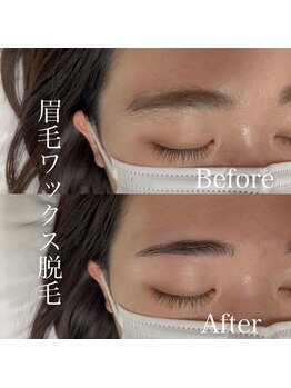 ミュー(mieux)/眉毛ワックス脱毛