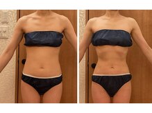 シェリール(Cherir)の雰囲気（キャビ＆レメディで理想の体型へ☆歪みや不調には美骨整体♪）