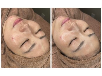 マヴィー(MAVIE)/☆ララピール☆