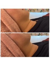 シュガー(Sugar...iyr)/レモンボトル