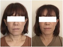 美容整体ウェリナ あま甚目寺院/小顔矯正/骨盤矯正/美脚サロン