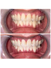 コナホワイトニング 神保町/セルフホワイトニング神保町