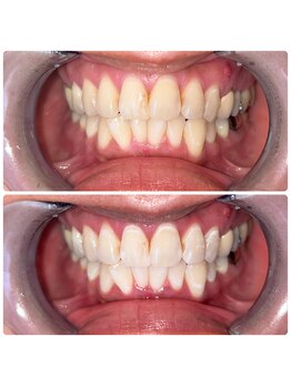 コナホワイトニング 神保町/セルフホワイトニング神保町