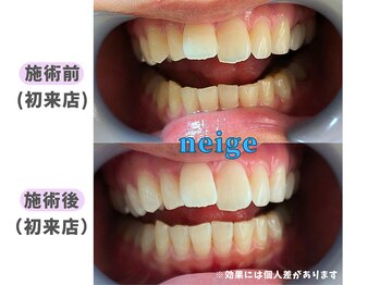 ネージュ(neige)/10代後半/女性