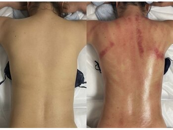 epani　Beauty Salonの写真/「何をしても体型が変わらなかった…」そんなお悩みの方におすすめ！短期間で叶える本格サイズダウン。