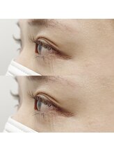 シーディーエム(cdm)/カラーバインドロック