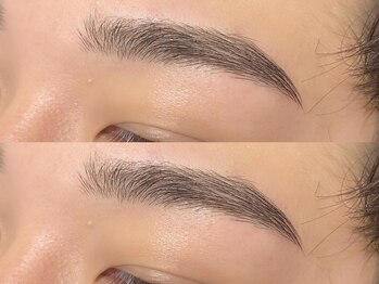 アイクイック 北千住店(Ai Quick)/メンズワックス脱毛