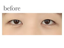 ヴィライズ 船橋(VIRISE)/before→