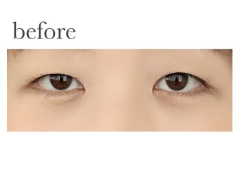 ヴィライズ 船橋(VIRISE)/before→