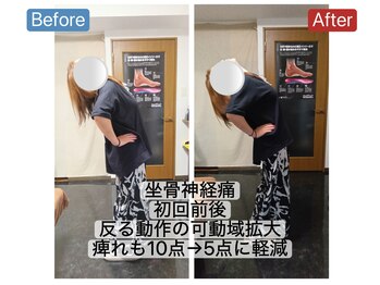 アンティオール 札幌店/40代女性　お尻と足の痺れ