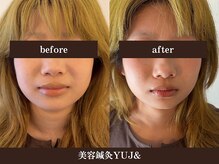 ユジュアンド(YUJ&)の雰囲気（小顔矯正＋電気美容鍼）