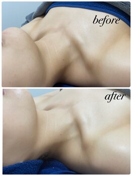 ラルーチェ(La luce)/鎖骨美人コース！