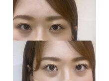 ロストシティー(LOSTCITY)/似合わせLash lift★