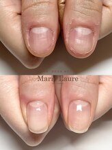 マリーロール 梅田店(Marie Laure)/自爪育成/深爪矯正/ネイルケア