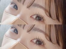 ルークスネイル(LOCUS NAIL)/