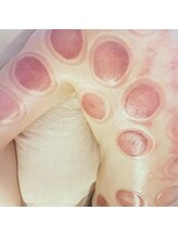 プルトア/肩甲骨まわりスッキリ