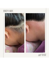 スプランドゥール(Splendeur)/レディース【うなじ】 &nbsp;Wax＋光