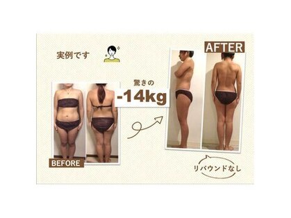 ラヴィニティ 池袋店(Lavinity)の写真