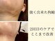インディバ ミマリ(INDIBA ミマリ)の写真