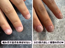 ココネイル(coco.nail)/コンプレックス爪を美爪にします