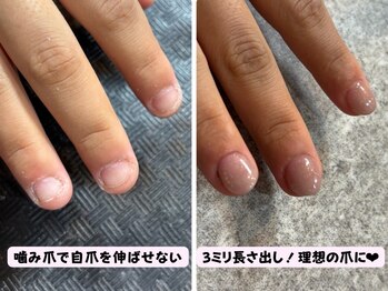 ココネイル(coco.nail)/コンプレックス爪を美爪にします