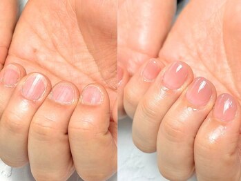 ナチュリア(Natulea)の写真/深爪を自然にカバー！特殊チップで自爪風の長さ出し◎フィルイン対応で育成もOK♪