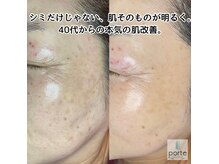 ポルテ(porte)の雰囲気（結果にこだわるプロが厳選！最新機器でシミを徹底ケア）