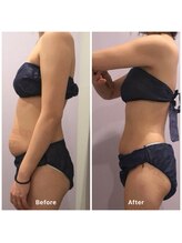 ナレル(narrel)/(新潟市/骨盤/痩身/ダイエット)