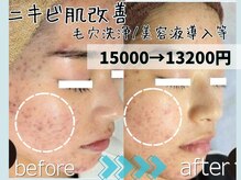 マルサンカクシカク(○△□)