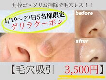 カリスボーテ 関本店