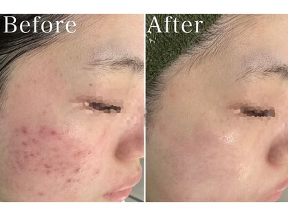 ベル 大和(Belle)の写真