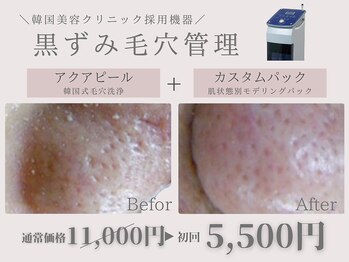 HEYON【毛穴/肌質改善専門サロン】心斎橋/大人気♪透明感のある素肌へ