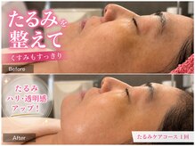 サロンドデュイの雰囲気（40代疲れ顔・たるみ改善・小顔・若見えハリ艶フェイシャル）