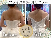 スリムプロ 天王寺店(Slimpro)/ブライダルエステ☆