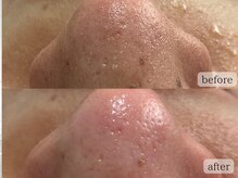 ライリー(Rairy)の雰囲気（【毛穴/角質/黒ずみ】オーダーメイドスッキリ毛穴洗浄）