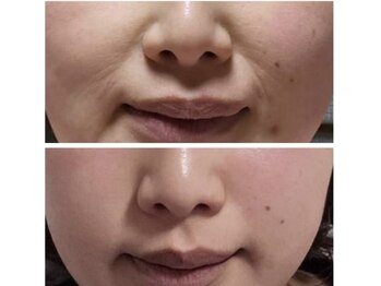 BBC 田園調布/スピダイヤ効果