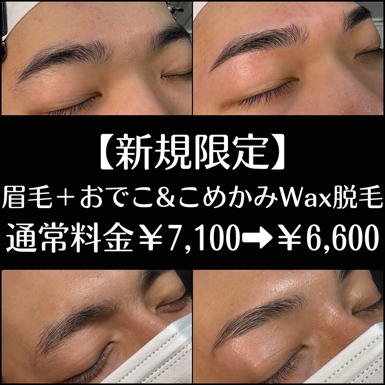【新規限定】トーンUP！美眉毛＋おでこ&こめかみWax脱毛 ￥7,100→￥6,600