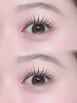 ムニ(muni)/NO.1!!
