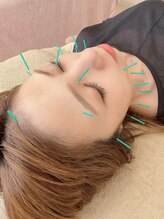 ヒーリングサロン アージュ(A-je)/★美顔鍼＋小顔矯正★