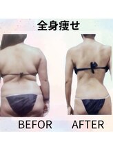 サロンド ヴィーナス 葛西店/全身痩せ★結果重視痩身ケア