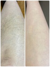 グラナダ 2F(Granada)/