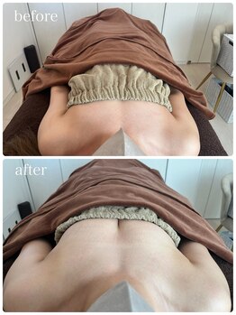 リノ 行橋(lino)/◇バストアップ症例◇30代