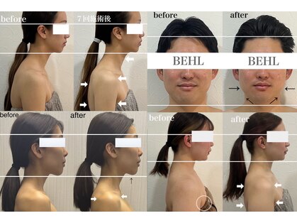 ベール(BEHL)の写真